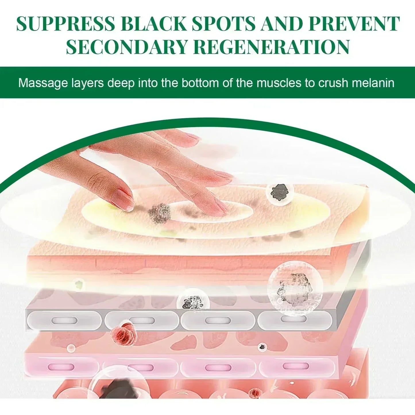 EELHOE Dark Spot Removal Serum Remove Melasma Fade Pigmentation Brighter Chloasma Sun Spot Anti Aging Whitening Sprout Cream